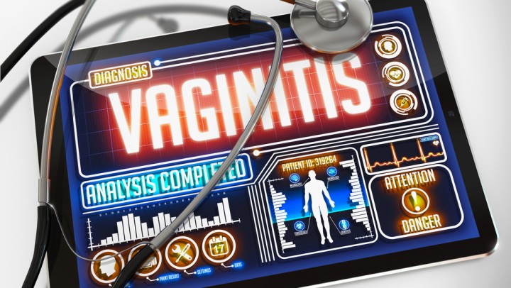 Vaginitis